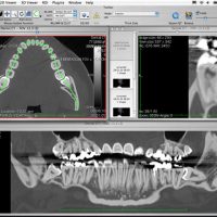 Curved-MPR-02.jpg