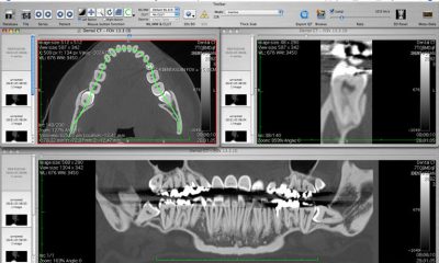Curved-MPR-02.jpg