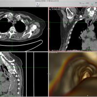 Endoscopy-02.jpg