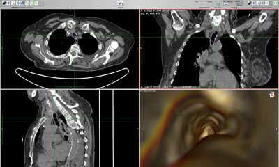 Endoscopy-02.jpg