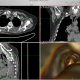 Endoscopy-02.jpg