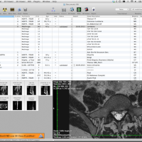 osirix6.png