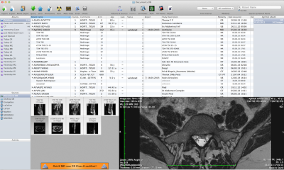 osirix6.png