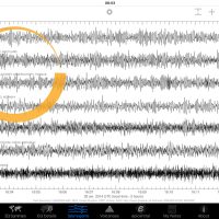 Divers sismographes sont disponibles dans l'application dont l'un situé en France